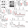 NAT10 regulated the ac4C acetylation of Lipin1 mRNA in OPCs.