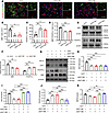 Downregulation of NAT10 inhibits OPC differentiation by suppressing Lipin1