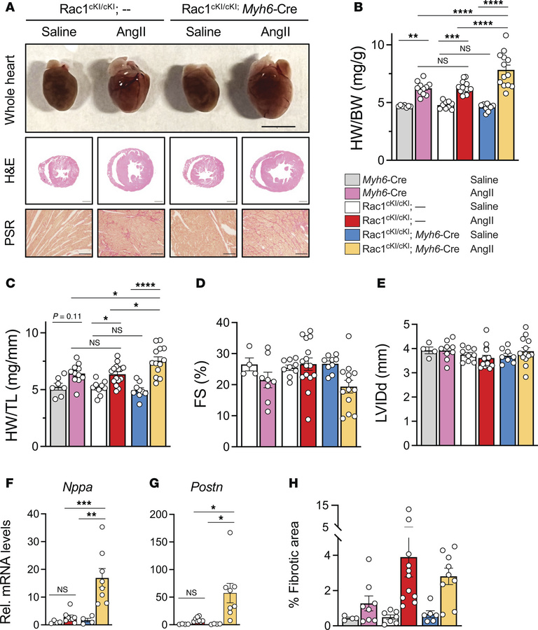 Cardiomyocyte-specific Rac1 conditional knockin mice develop more severe...