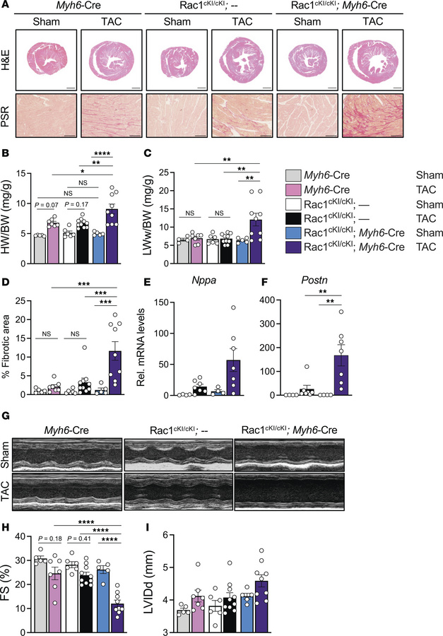 Cardiomyocyte-specific Rac1 conditional knockin mice develop more severe...