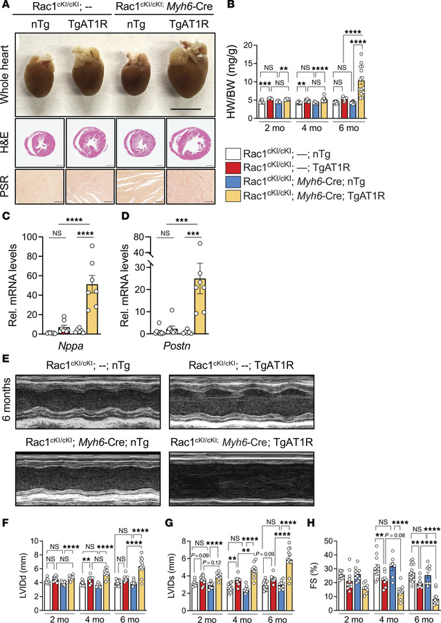Cardiomyocyte-specific Rac1 conditional knockin mice develop more severe...