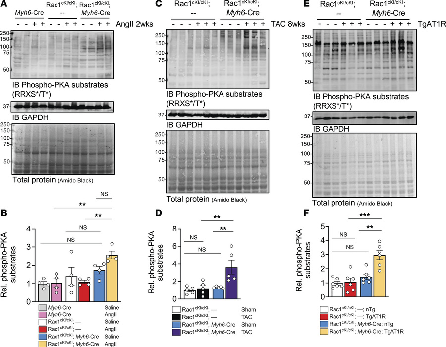 Rac1 conditional knockin mice subjected to hypertrophic stress have elev...