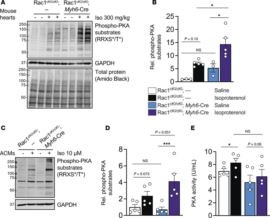 Rac1 conditional knockin cardiomyocytes exhibit hyperphosphorylation of ...