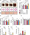Cardiomyocyte-specific Rac1 conditional knockin mice develop more severe ca