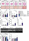 Cardiomyocyte-specific Rac1 conditional knockin mice develop more severe ca