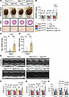 Cardiomyocyte-specific Rac1 conditional knockin mice develop more severe ca