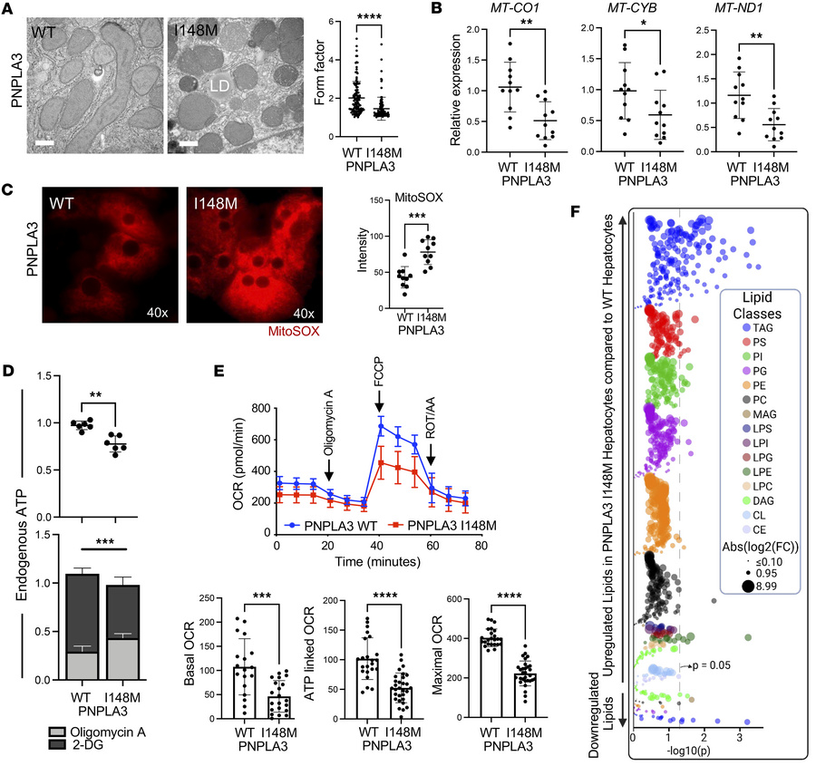 The PNPLA3-I148M mutation leads to mitochondrial dysfunction in primary ...