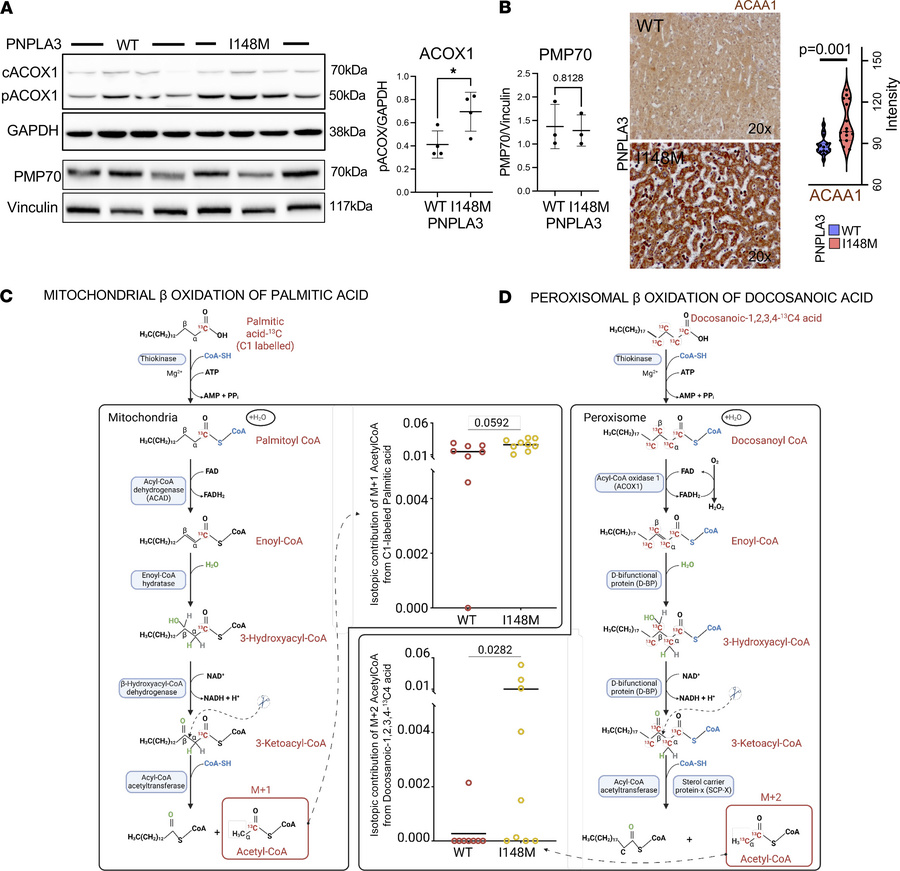 Peroxisomal β-oxidation is increased in human PNPLA3-I148M hepatocytes.
...