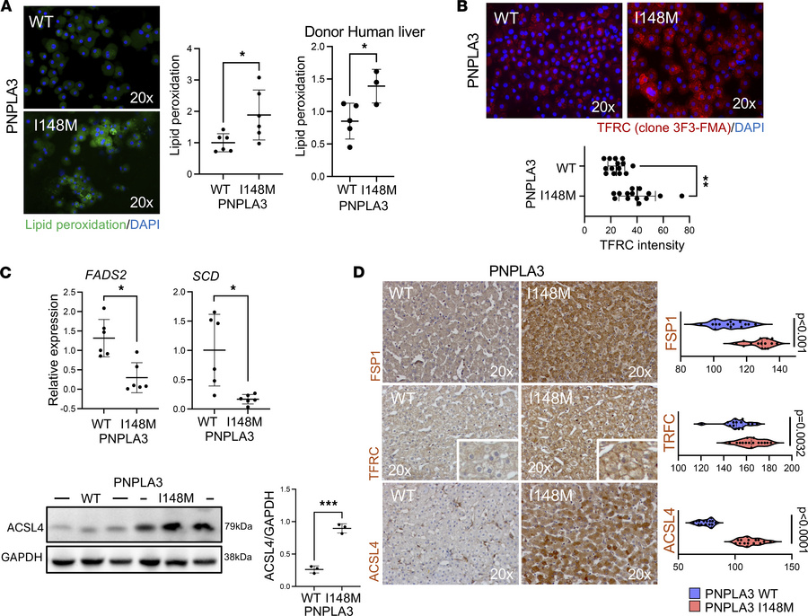 Functional characterization of ferroptosis in primary human hepatocytes....