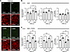 Programmed cell death is attenuated in primary human hepatocytes carrying t