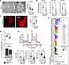 The PNPLA3-I148M mutation leads to mitochondrial dysfunction in primary hum