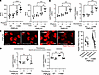 Functional assessment of peroxisomal β-oxidation in human PNPLA3-I148M hepa