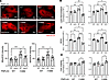 The ferroptosis inhibitors Lipro1 and Fer1 suppress cellular stress and cel