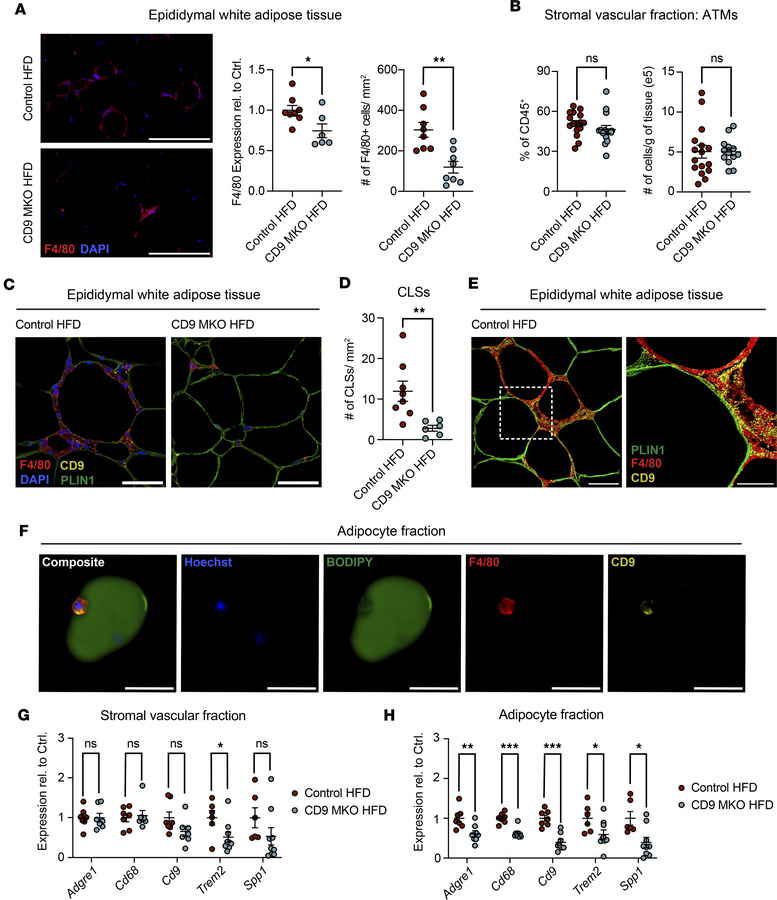 CD9 promotes adipose tissue macrophage accumulation, crown-like structur...