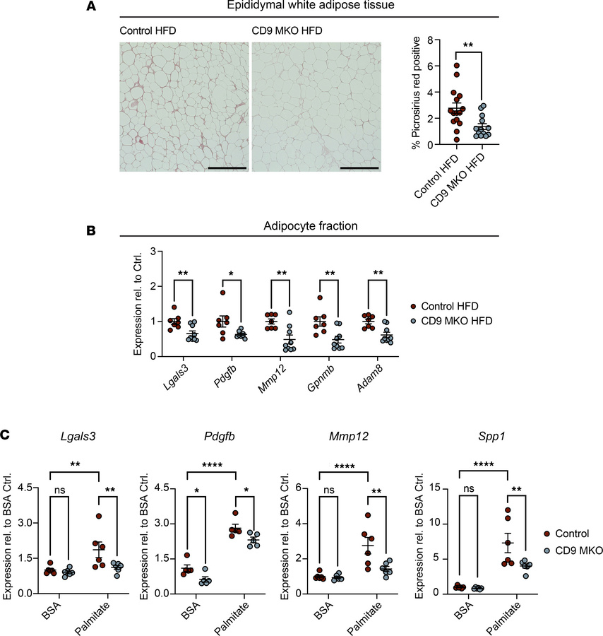 Myeloid-intrinsic CD9 promotes adipose tissue fibrosis and macrophage pr...