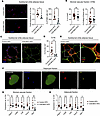 CD9 promotes adipose tissue macrophage accumulation, crown-like structure f