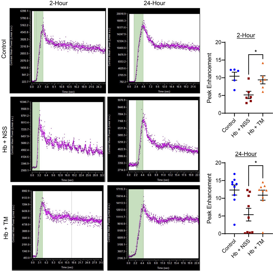 Administration of TM 2 or 24 hours after a cell-free hemoglobin challeng...
