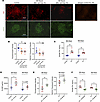 Cell-free hemoglobin reduces TM expression and increases circulating concen