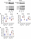 Vascular integrity and injury biomarkers are improved in the lungs of SCD m