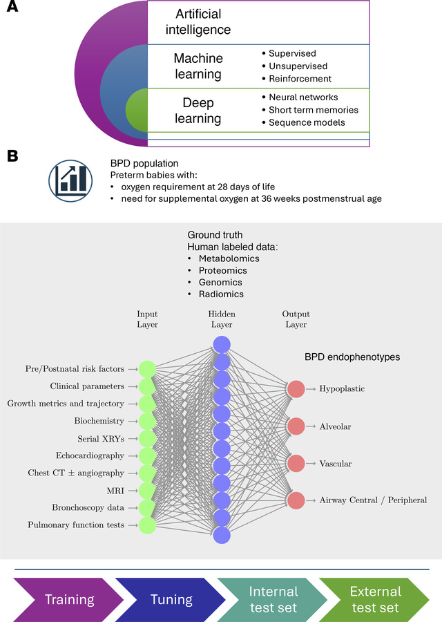 Artificial intelligence for defining and managing BPD endotypes.
(A) The...