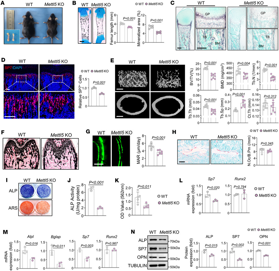 
Mettl5 deficiency leads to reduced bone mass and impaired osteogenic di...