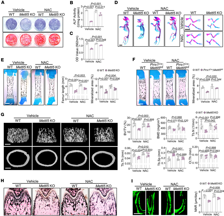 NAC supplementation partially rescues the impaired osteogenesis in Mettl...
