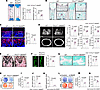 Deletion of Mettl5 impairs osteogenesis in limb mesenchyme–specific KO mice