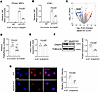METTL5 regulates the translation of OSER1.