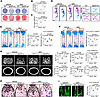 NAC supplementation partially rescues the impaired osteogenesis in Mettl5-K