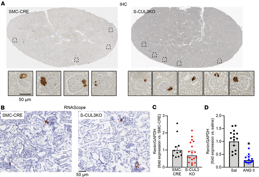 Renin expression in the kidney.
(A) Representative IHC staining for reni...