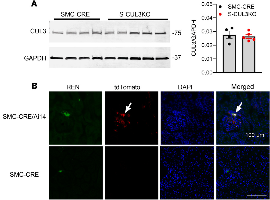 SMC-CRE activity in JG cells.
(A) Representative Western blot showing ex...