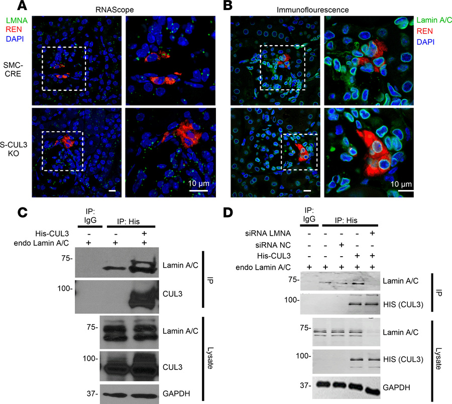 Renal Lamin A/C expression and interaction with CUL3.
(A) Fluorescence i...