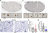 Renin expression in the kidney.