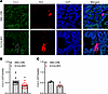 Decreased Cul3 expression in JG cells.