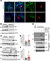 Renal integrin β1 expression.