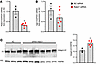 Role of Rab21 in integrin β1 in CUL3KO cells.