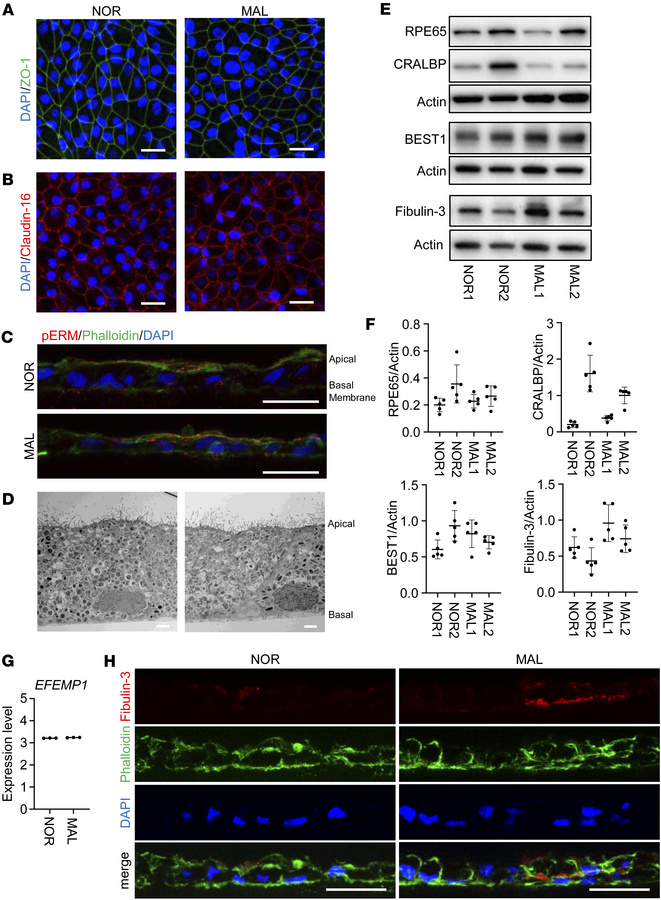 Altered fibulin-3 distribution in MAL iPSC-RPE.
Induced pluripotent stem...