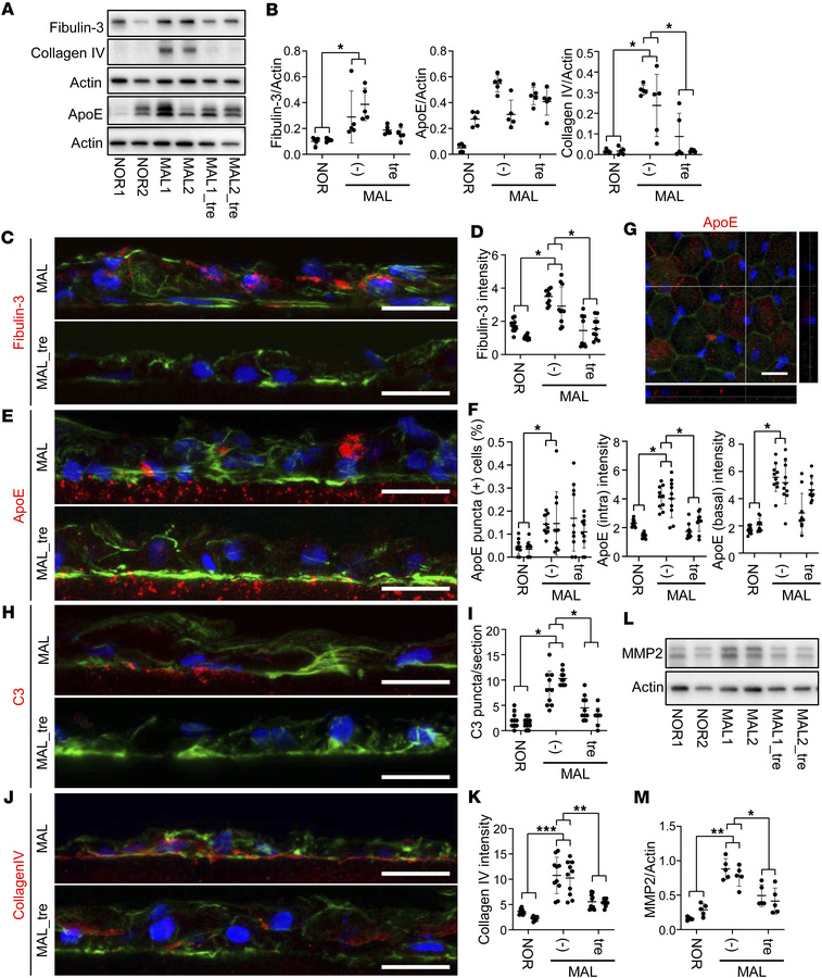 Improvement of drusen-like deposits and extracellular matrix dysregulati...