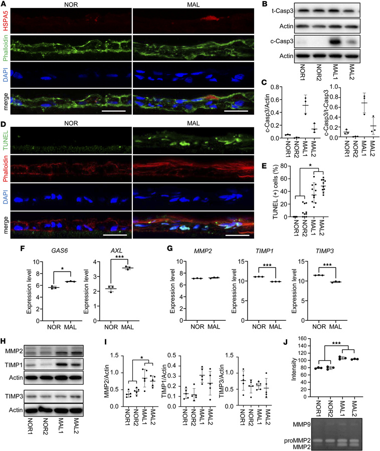 Apoptosis and extracellular matrix degradation in MAL iPSC-RPE cells.
iP...