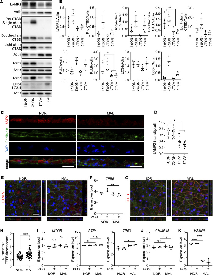 Decreased lysosomal biogenesis in MAL iPSC-RPE cells.
iPSC-RPE cells wer...