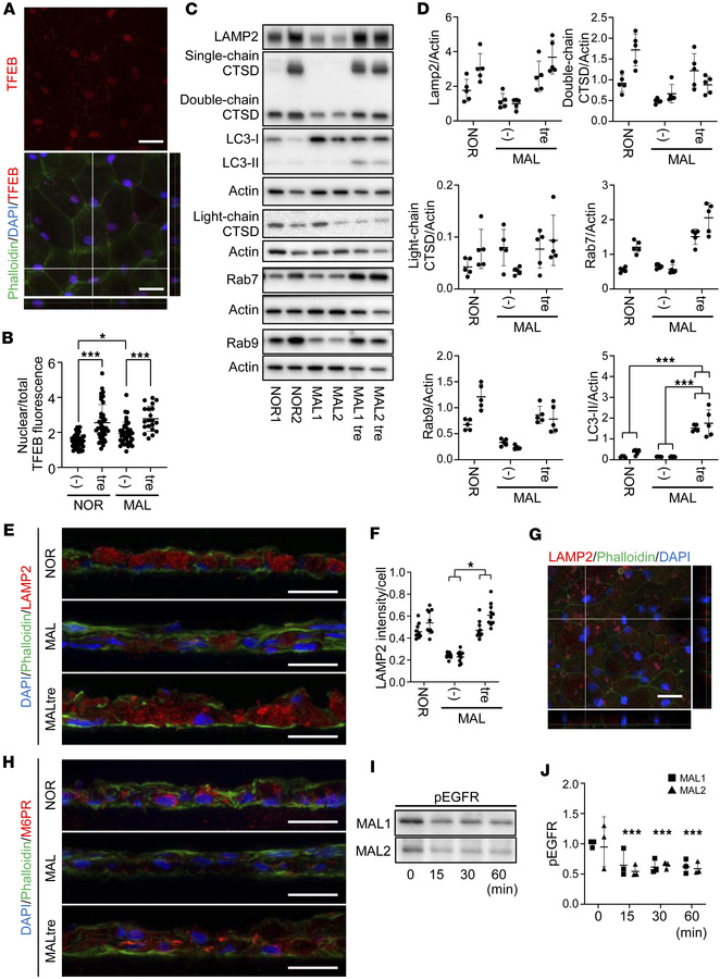 Improvement of lysosomal function by trehalose in MAL iPSC-RPE cells.
iP...