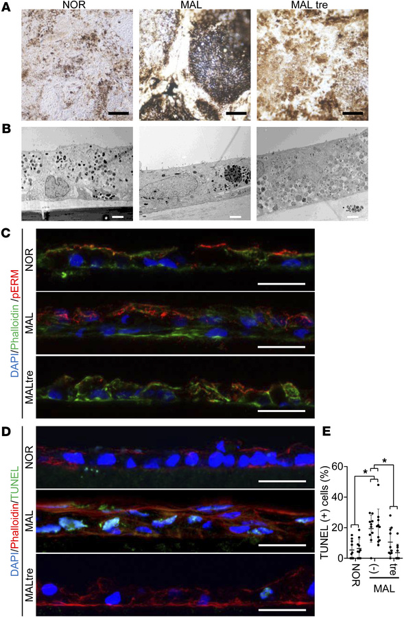 Rescue of cellular morphology and suppression of apoptosis by trehalose ...