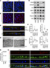 Altered fibulin-3 distribution in MAL iPSC-RPE.
