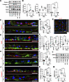 Improvement of drusen-like deposits and extracellular matrix dysregulation