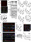 Improvement of lysosomal function by trehalose in MAL iPSC-RPE cells.