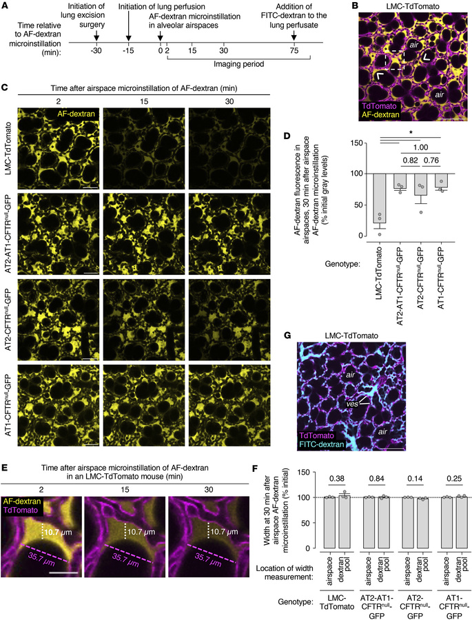 Real-time confocal imaging of liquid secretion in live alveoli.
(A–G) Il...