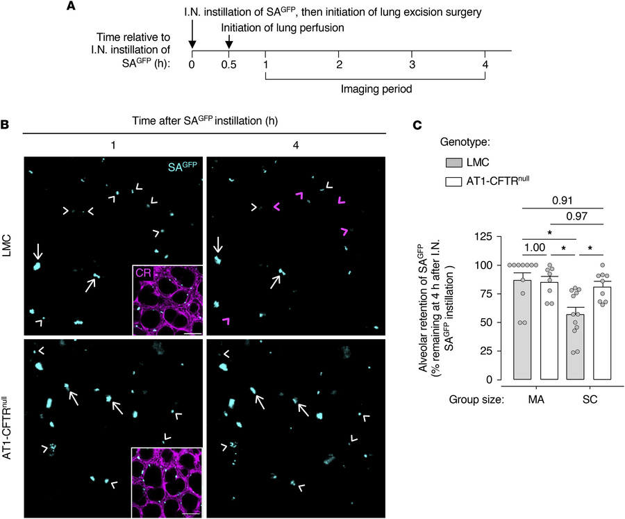 CFTR in AT1 cells promotes bacterial clearance in alveoli.
(A–C) The ill...