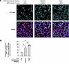 Cre recombination is spatially heterogeneous across alveoli of AT1-CFTRnull