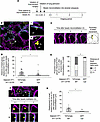 CFTR in AT1 cells promotes particle clearance in alveoli.