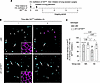 CFTR in AT1 cells promotes bacterial clearance in alveoli.